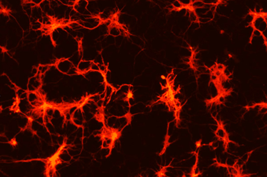 Stained neurons